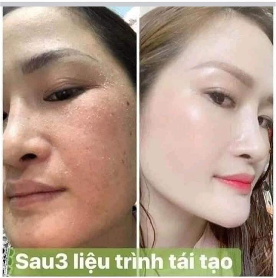 Tái tạo da nhân sâm MQ SKIN